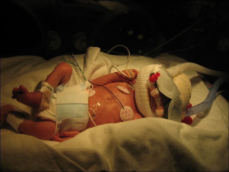 Sebastian so he can't pull out his tubes